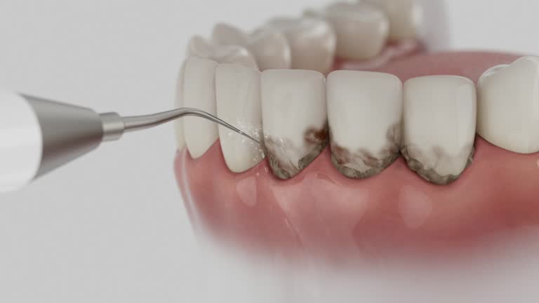Reliable Dental contractor in Bremen, OH by Dentist Open Now